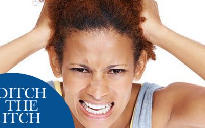 Ditch the Itch Part 1: Causes of Dandruff